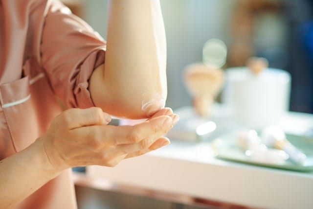 Close-up of a person applying CBD cream to their elbow, highlighting topical use for skincare or inflammation relief.